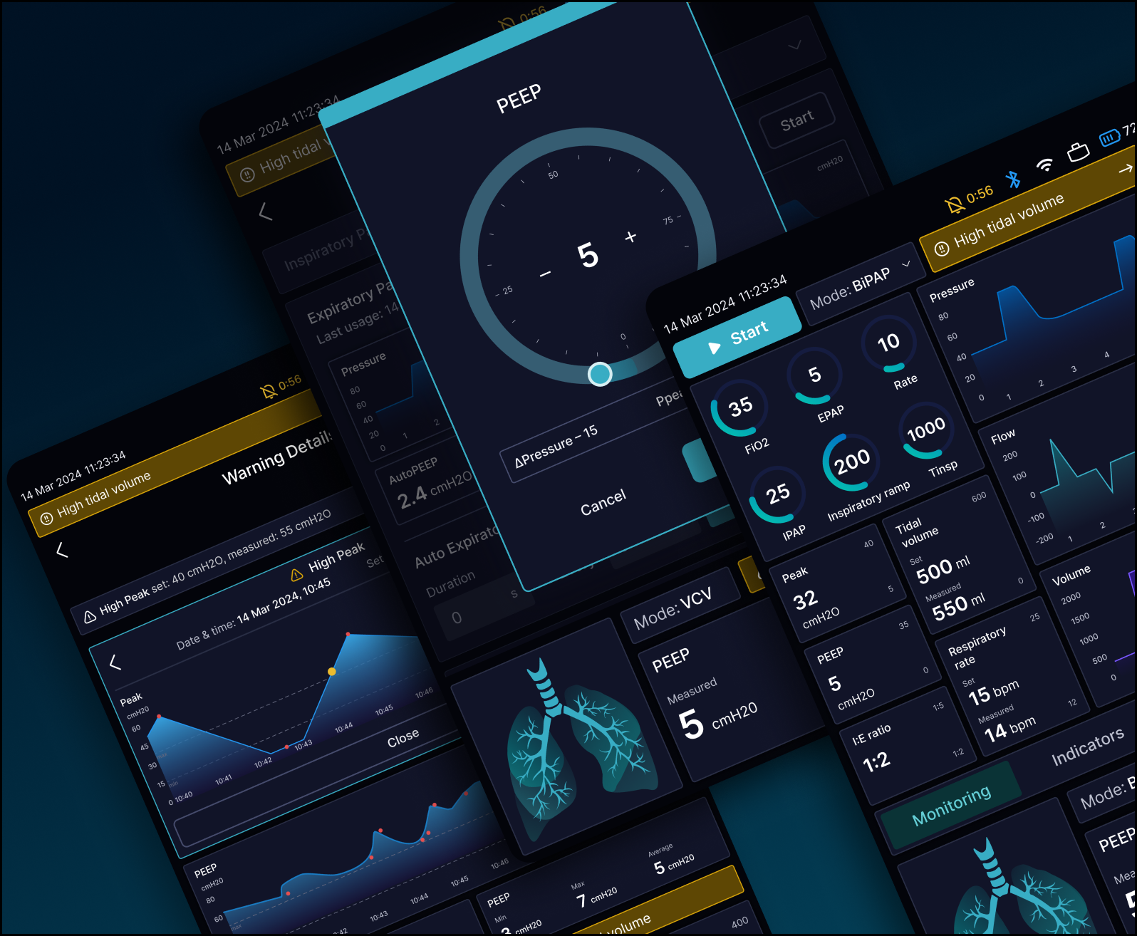 VENTILATOR DATA APPLICATION