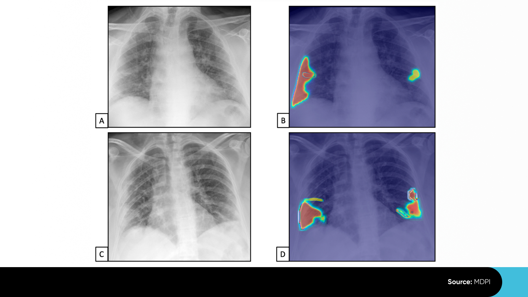 computer vision in healthcare