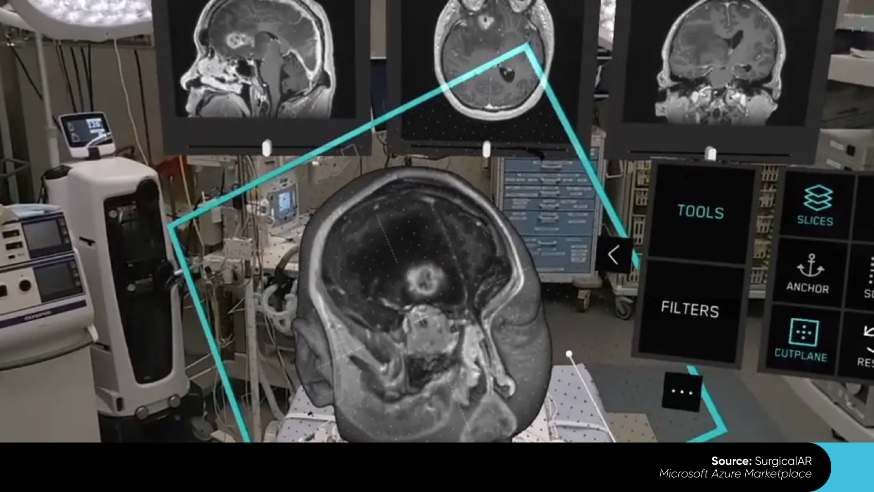 computer vision in healthcare