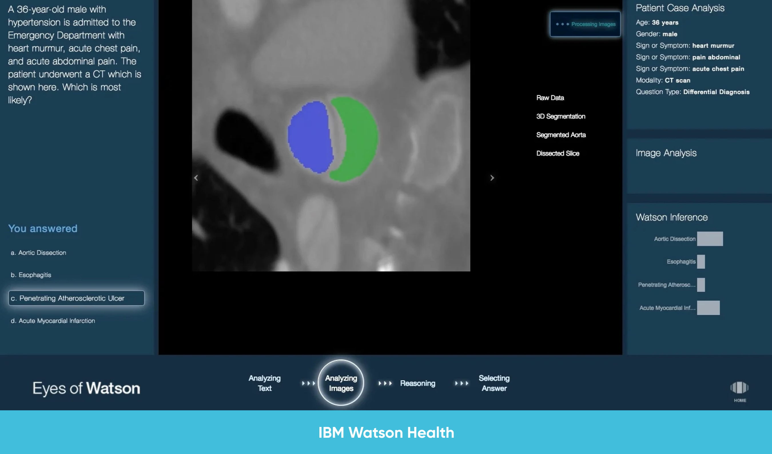 IBM Watson